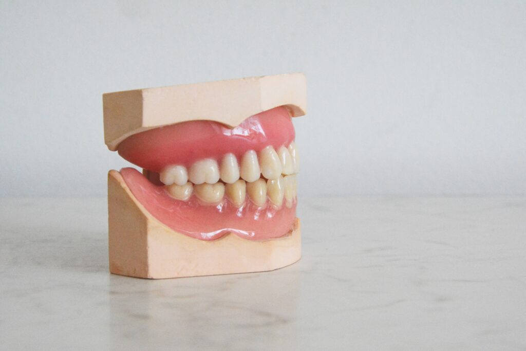 Long-Term Effects of Grinding and Clenching Your Teeth
