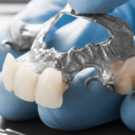 Dental Bridge Can Keep Your Teeth Healthier