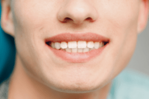 Health Benefits of Straight Teeth