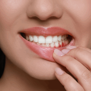 gums