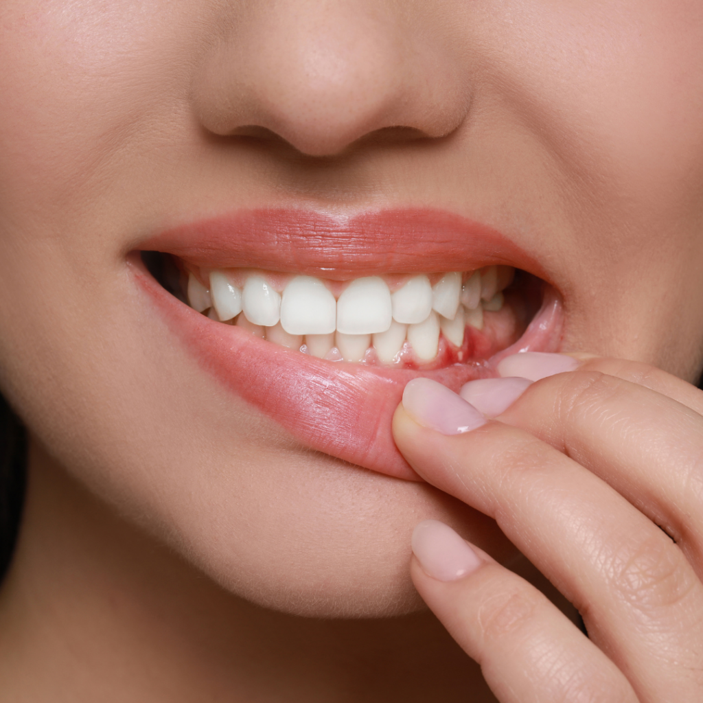 gum disease